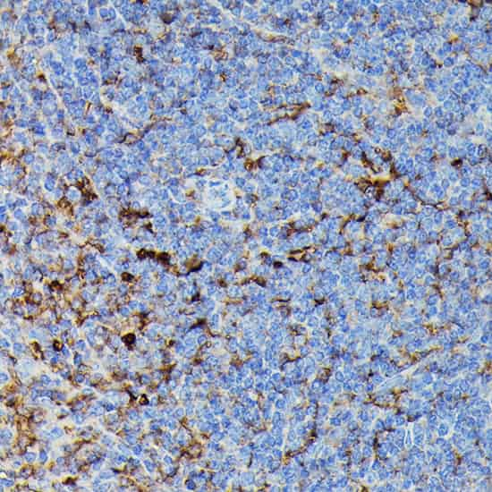 Immunohistochemistry of paraffin-embedded Rat spleen using HLA-DPB1 Polyclonal Antibody at dilution of 1:100 (40x lens).Perform high pressure antigen retrieval with 10 mM citrate buffer pH 6.0 before commencing with IHC staining protocol.