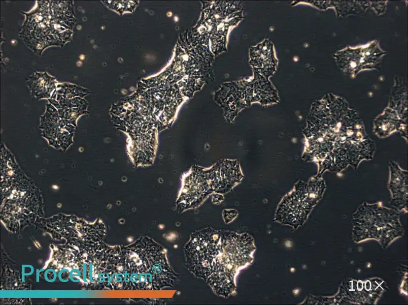 GT1-1 Cell Complete Medium - 1