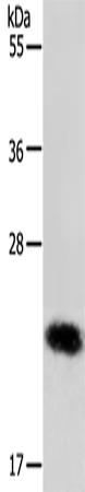 Western Blot analysis of MCF-7 cell using RAB22A Polyclonal Antibody at dilution of 1:650