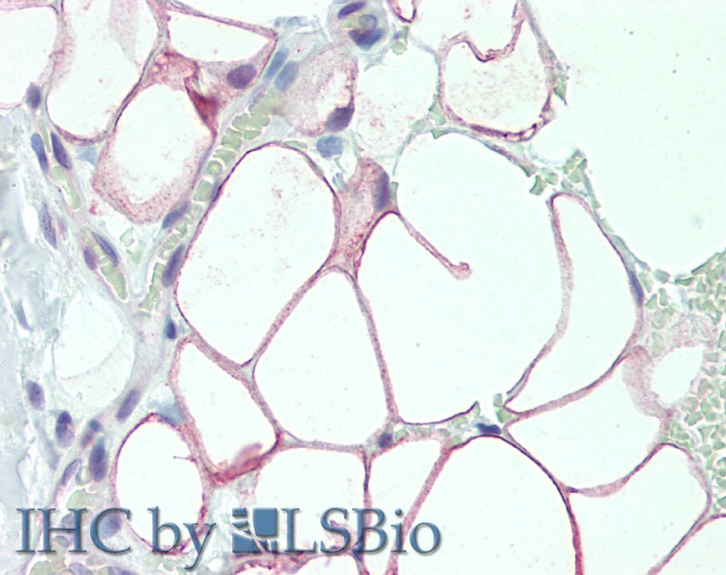 Immunohistochemistry of paraffin-embedded Adipose Tissue tissue using DCBLD2 Polyclonal Antibody at dilution of 1:50(Elabscience Product Detected by Lifespan).