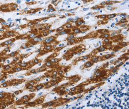 AIFM1 Polyclonal Antibody - 2