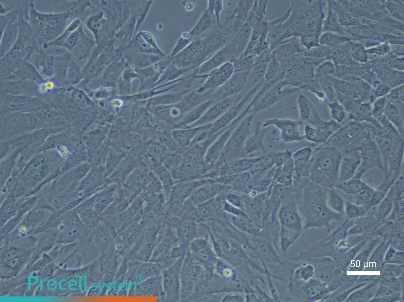Rabbit Lung Fibroblast Complete Medium - 4