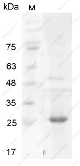 Recombinant Human MMP7 protein(N-His) - 1