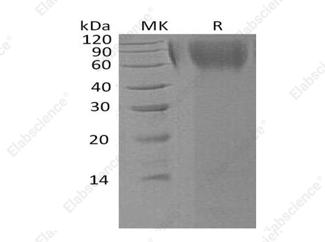 Recombinant Human LAMP1/CD107a Protein (His Tag) - 1