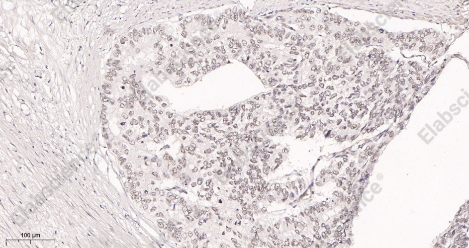Recombinant KDM1A Monoclonal Antibody - 3