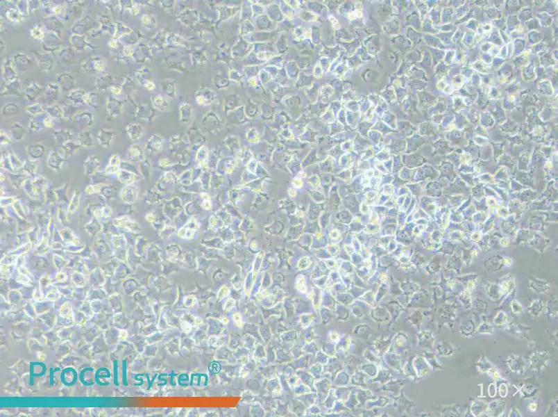 92-1 [Human uveal melanoma] Cell Complete Medium - 1