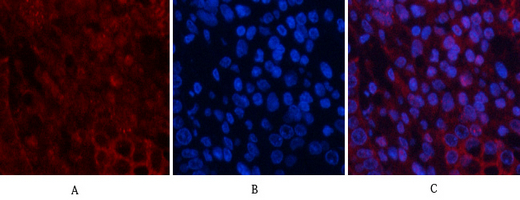 Recombinant Akt (pan) Monoclonal Antibody - 3