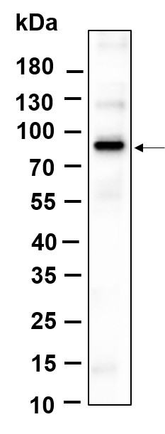 Recombinant Phospho-β Catenin (Ser37) Monoclonal Antibody-searchlist-1