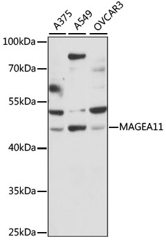 Western blot analysis of extracts of various cell lines using MAGEA11 Polyclonal Antibody at 1:1000 dilution.