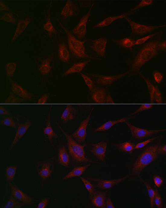 Immunofluorescence analysis of BALB-3T3 cells using NSF Polyclonal Antibody at dilution of 1:100 (40x lens). Blue: DAPI for nuclear staining.