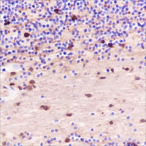 Recombinant Alpha B Crystallin Monoclonal Antibody - 2