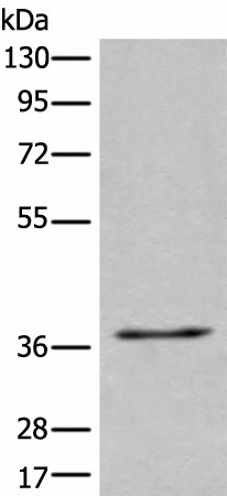 Western blot analysis of 231 cell lysate  using UBAC2 Polyclonal Antibody at dilution of 1:400