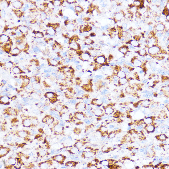 Immunohistochemistry of paraffin-embedded Rat ovary using ACAT1 Polyclonal Antibody at dilution of 1:100 (40x lens).