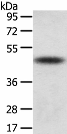 Western Blot analysis of Mouse adrenal gland tissue using TTC23 Polyclonal Antibody at dilution of 1/800