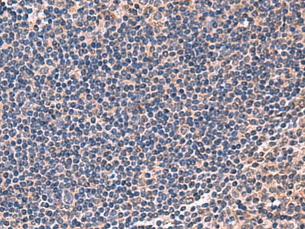 Immunohistochemistry of paraffin-embedded Human tonsil tissue  using IPPK Polyclonal Antibody at dilution of 1:50(?200)