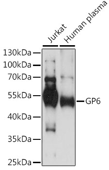 Western blot analysis of extracts of various cell lines using GP6 Polyclonal Antibody at 1:1000 dilution.