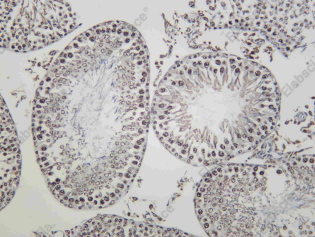 Recombinant YTHDC1 Monoclonal Antibody - 2