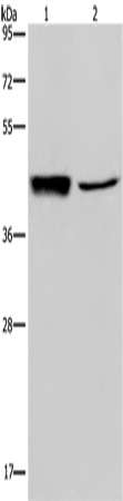 Western Blot analysis of Human hepatocellular carcinoma tissue and A549 cell using GRPR Polyclonal Antibody at dilution of 1:300