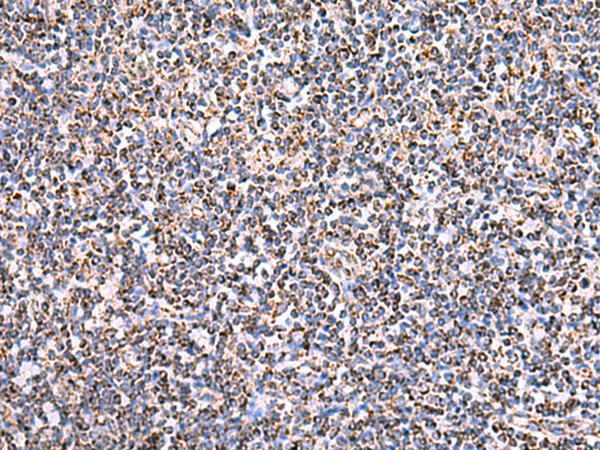 Immunohistochemistry of paraffin-embedded Human tonsil tissue  using HSF2BP Polyclonal Antibody at dilution of 1:30(?200)