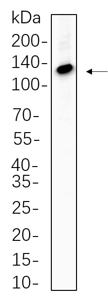 Recombinant ATP-Citrate Lyase Monoclonal Antibody-searchlist-1