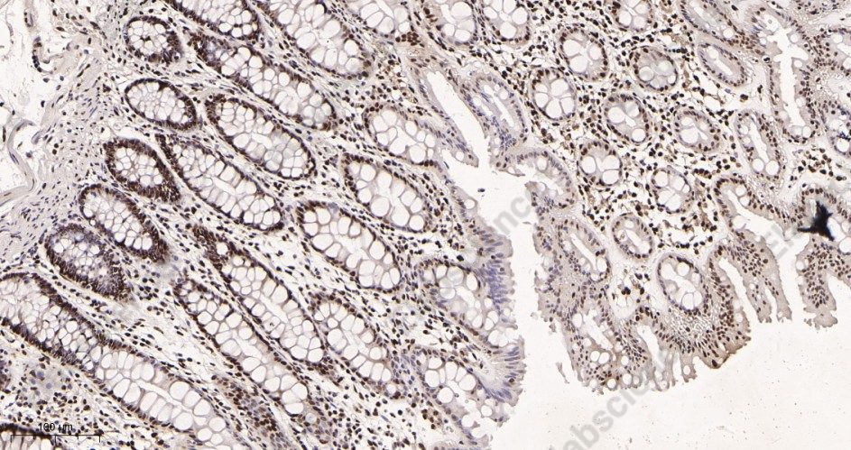 Recombinant KAP1 Monoclonal Antibody - 2