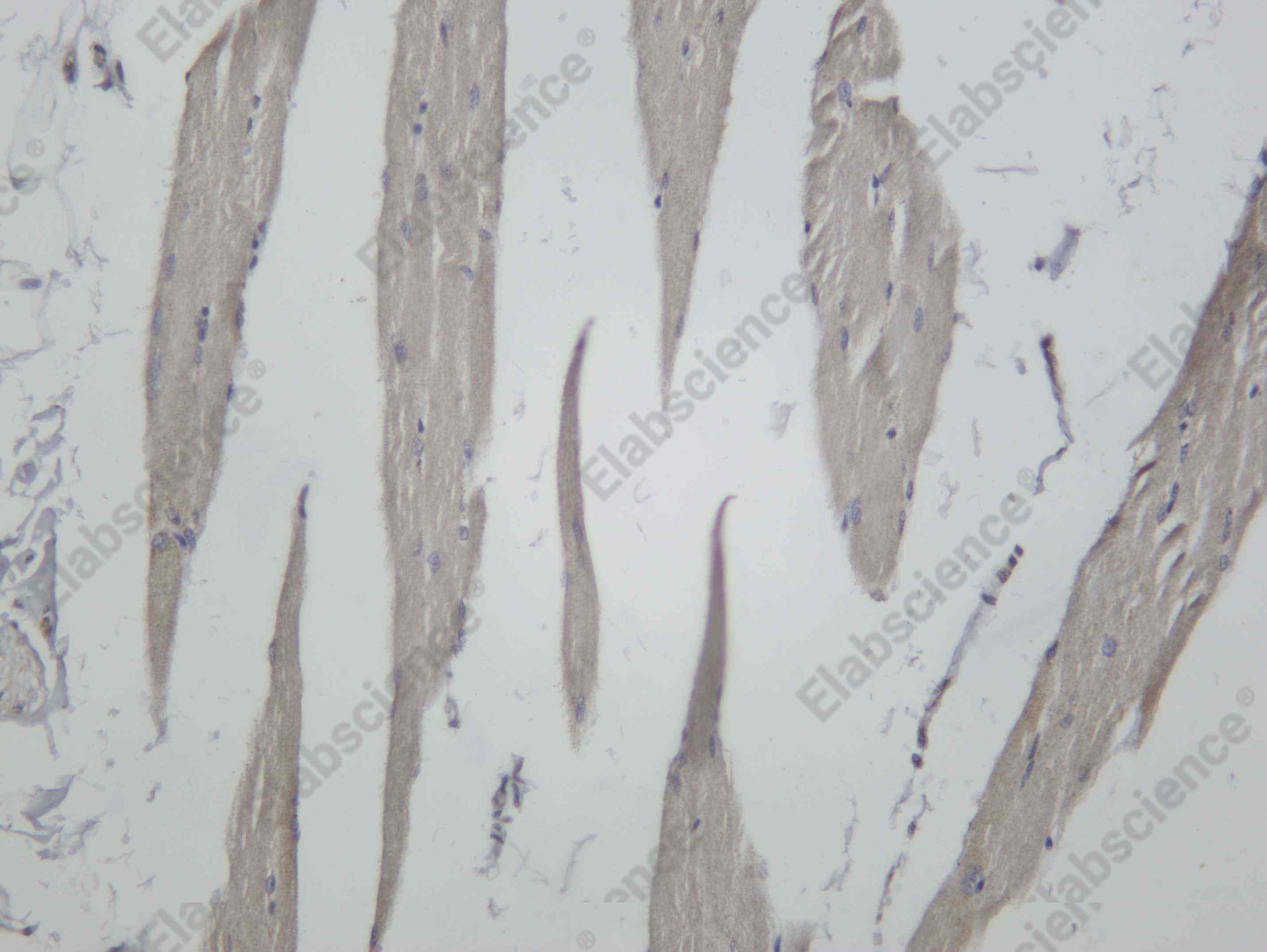 Recombinant IRAK4 Monoclonal Antibody - 3
