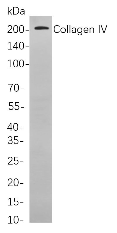 Recombinant Collagen IV Monoclonal Antibody-searchlist-1