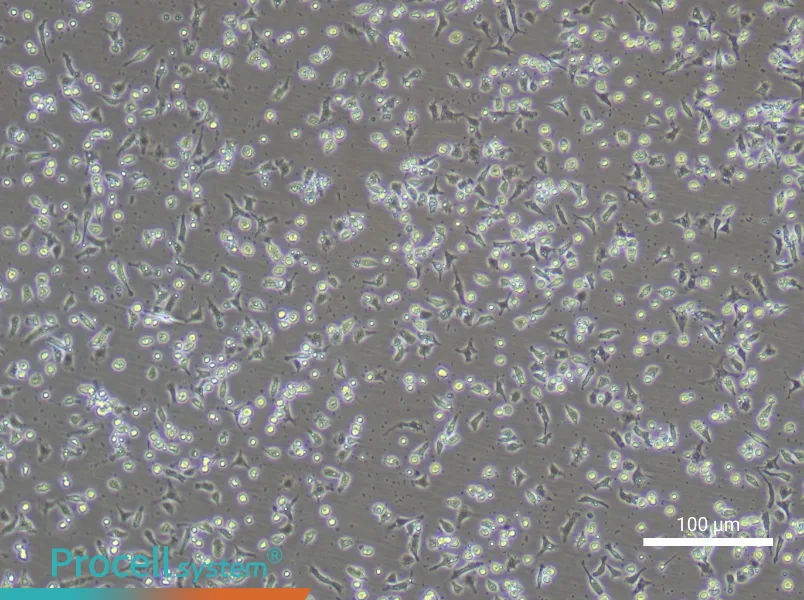 Mouse Peripheral Blood Monocyte Complete Medium - 2