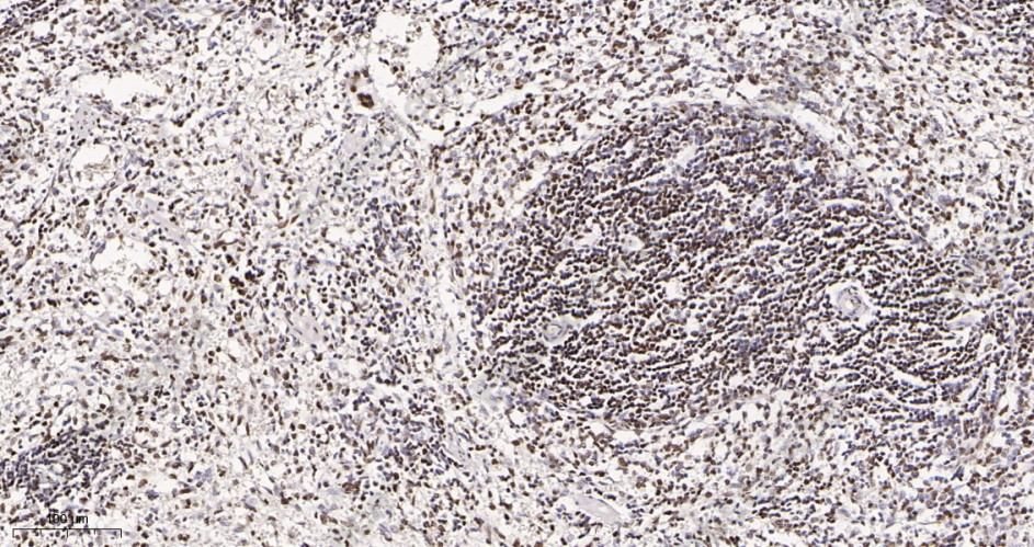 Recombinant HDAC2 Monoclonal Antibody - 3