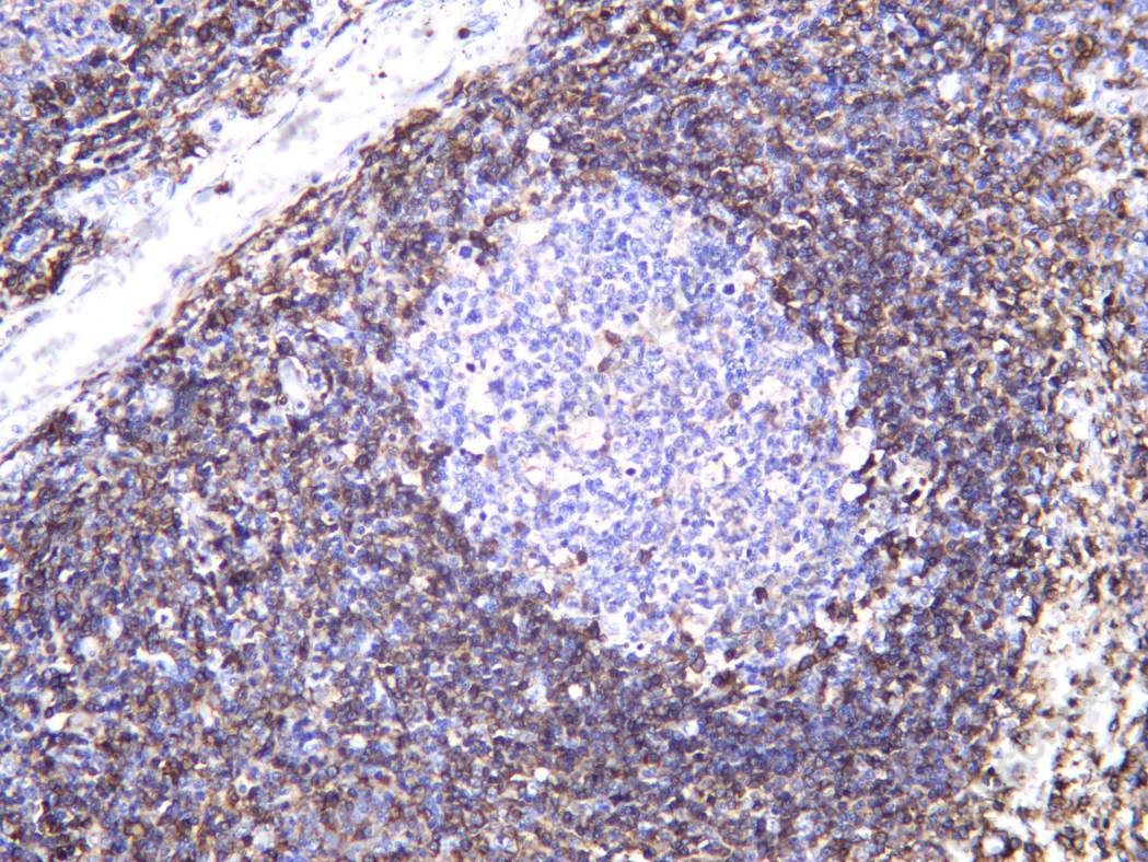 Recombinant CD32 Monoclonal Antibody - 2
