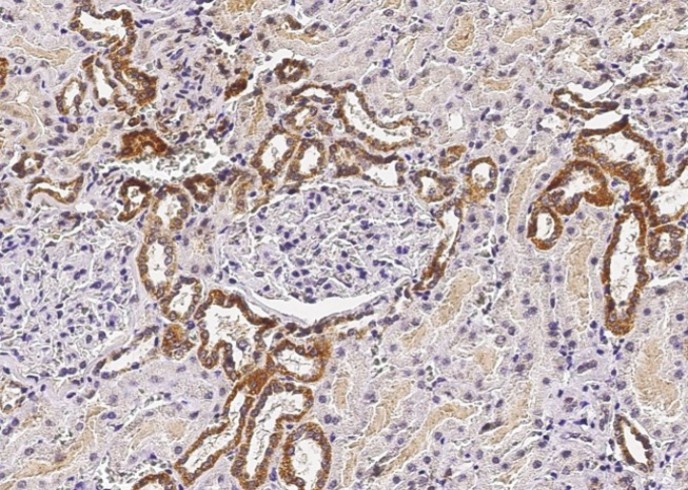 Recombinant ST6GAL1/ST6GAL-I Monoclonal Antibody - small - 2