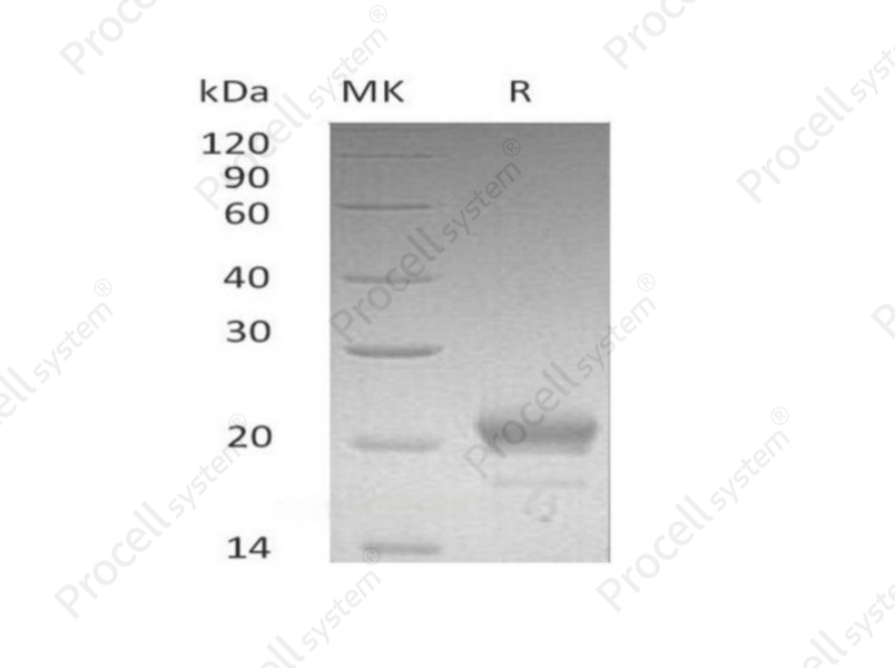 CXCL15/Lungkine (C-6His), Mouse, Recombinant