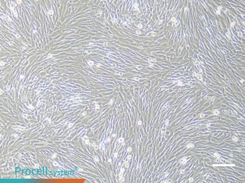 Mouse Pancreatic Stellate (Primary cell immortalization) Cell Complete MediumMouse Pancreatic Stellate (Primary cell immortalization) Cell Complete Medium - 3