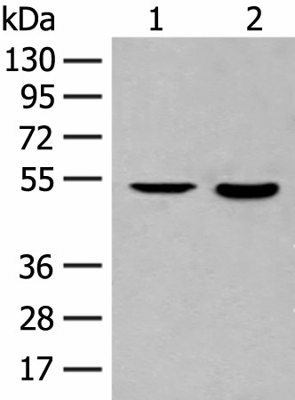 Western blot analysis of Jurkat cell and Human fetal brain tissue lysates  using IL7R Polyclonal Antibody at dilution of 1:800