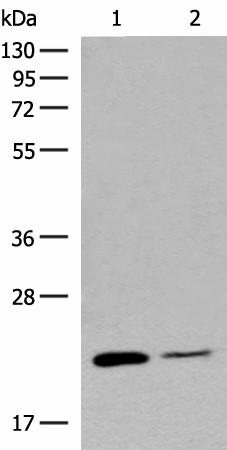 Western blot analysis of Human empty ileal tissue and Human ileum tissue lysates  using RAC3 Polyclonal Antibody at dilution of 1:400