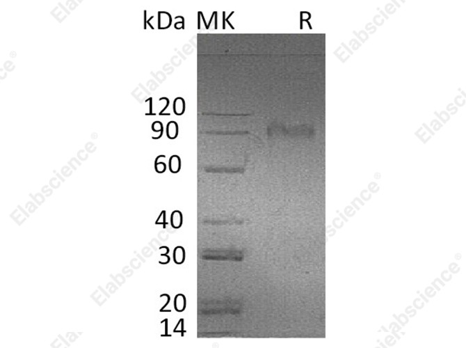 Recombinant Human AMIGO2 Protein (Fc Tag) - 1