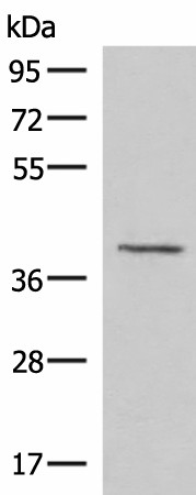 Western blot analysis of Human fetal brain tissue lysate  using MECR Polyclonal Antibody at dilution of 1:1000