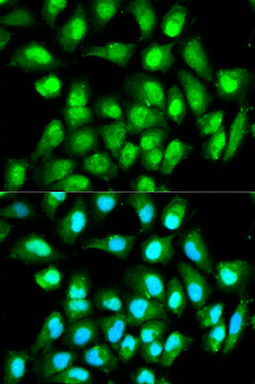 Immunofluorescence analysis of HeLa cells using RAN Polyclonal Antibody