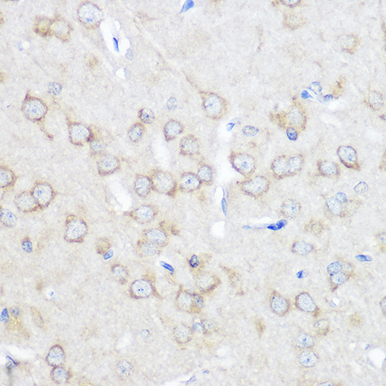 Immunohistochemistry of paraffin-embedded rat brain using ADORA1 Polyclonal Antibody at dilution of 1:100 (40x lens).Perform microwave antigen retrieval with 10 mM PBS buffer pH 7.2 before commencing with IHC staining protocol.