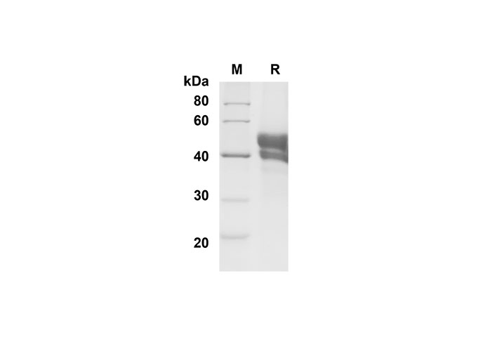 Recombinant Rat IL-2 Protein(His Tag)-产品推荐-1