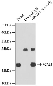 Immunoprecipitation analysis of extracts of HepG2 cells using HPCAL1 Polyclonal Antibody.Western blot was performed from the immunoprecipitate using HPCAL1 Polyclonal Antibody at a dilution of 1:1000.