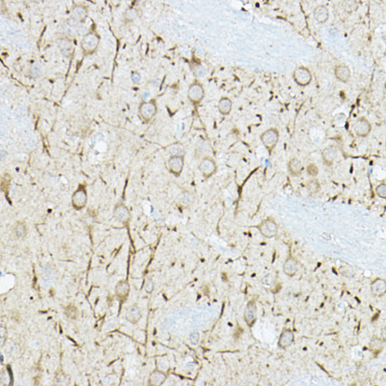 Immunohistochemistry of paraffin-embedded rat brain using DUSP6 Polyclonal Antibody at dilution of 1:100 (40x lens).Perform high pressure antigen retrieval with 10 mM citrate buffer pH 6.0 before commencing with IHC staining protocol.