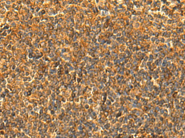 Immunohistochemistry of paraffin-embedded Human tonsil tissue  using HS1BP3 Polyclonal Antibody at dilution of 1:50(?200)