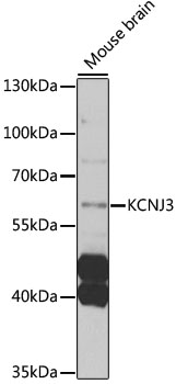 Western blot analysis of extracts of mouse brain using KCNJ3 Polyclonal Antibody at 1:1000 dilution.