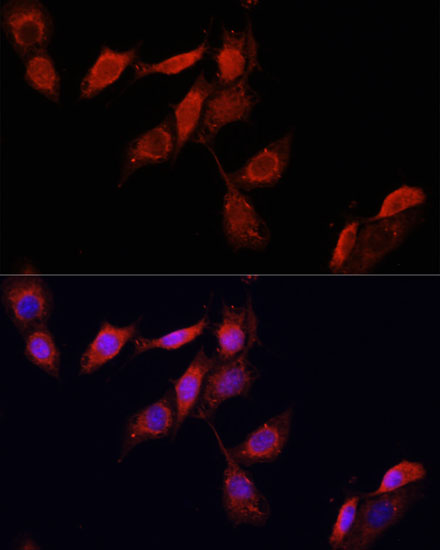 Immunofluorescence analysis of NIH/3T3 cells using GPER1 Polyclonal Antibody at dilution of  1:100. Blue: DAPI for nuclear staining.