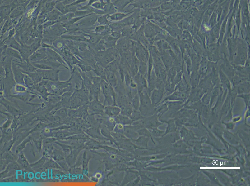 Rat Pulmonary Arteriolar Smooth Muscle Cell Complete Medium - 4
