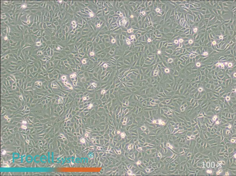9L/lacZ Cell Complete Medium - 3