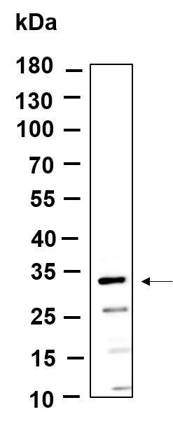 Recombinant MTX3 Monoclonal Antibody-searchlist-1