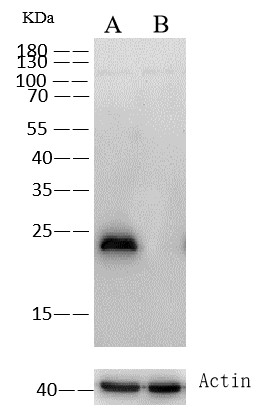 Recombinant GSTP1 Monoclonal Antibody - small - 2
