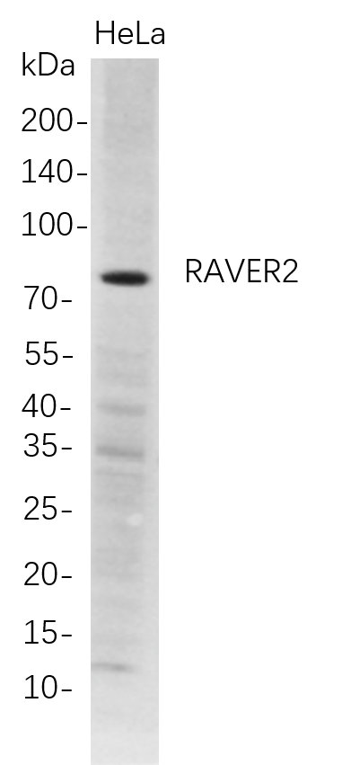 Recombinant RAVER2 Monoclonal Antibody-searchlist-1